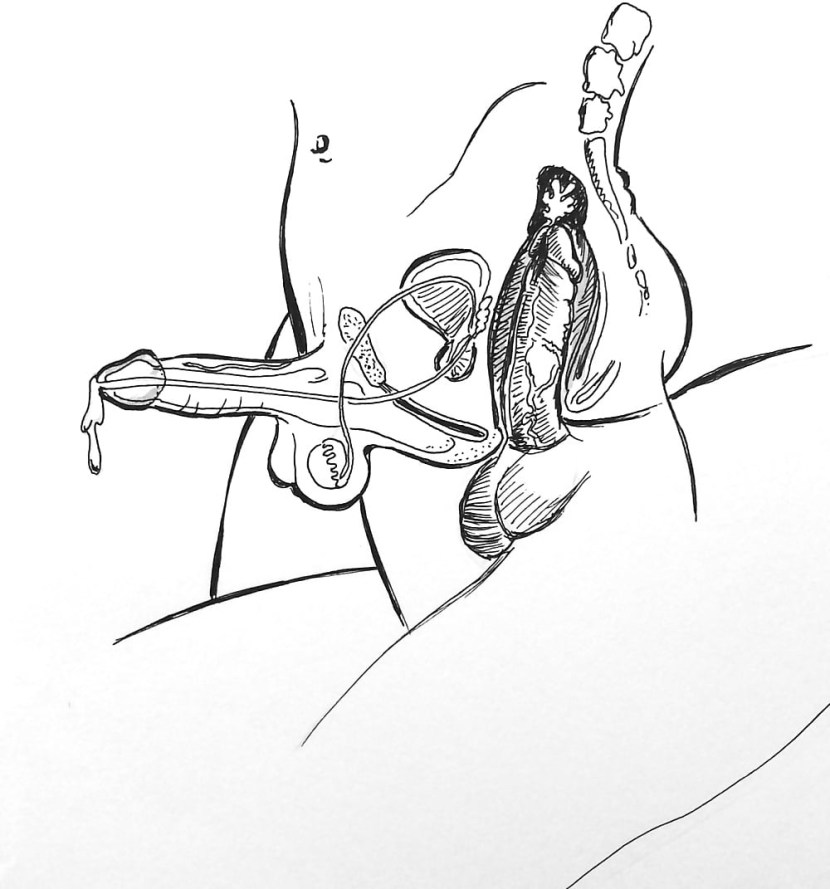 Uterus and vagina in the section