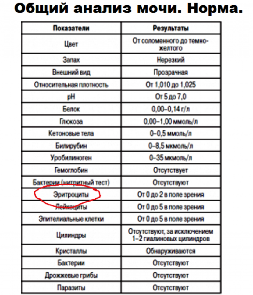 General urine analysis norm