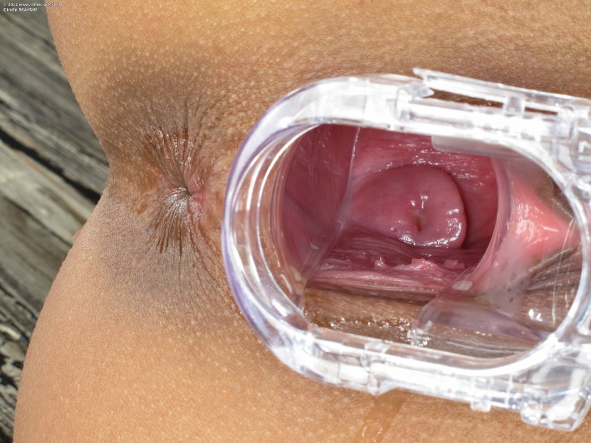 Vagina and uterus from the inside