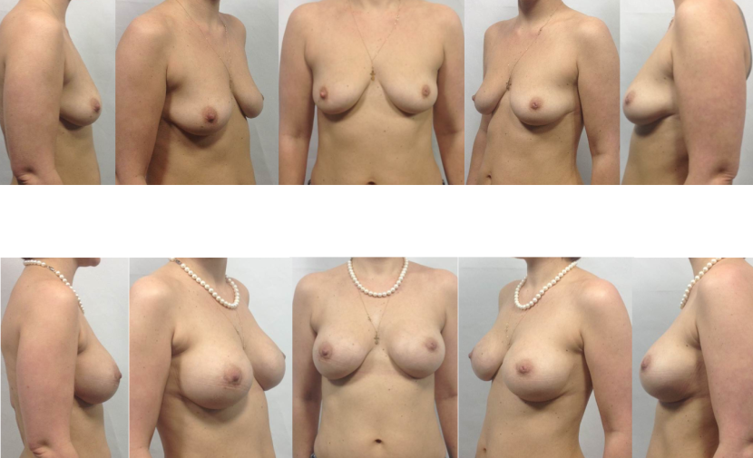 Naked chest of different shapes