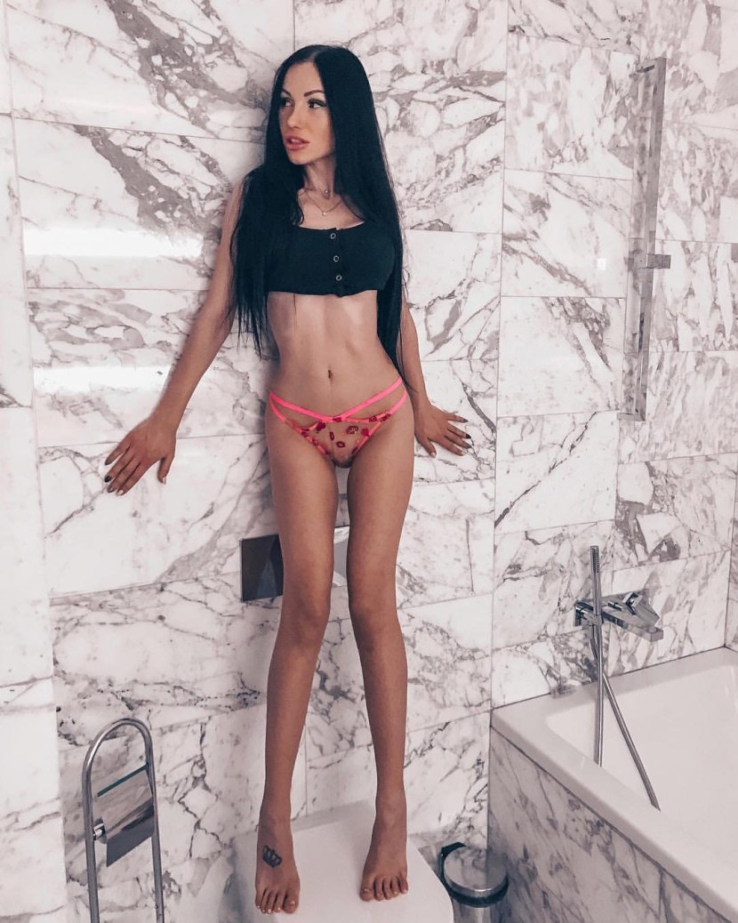 Mammoplasty Olga Buzova