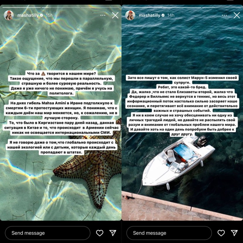 Mariam Tilyaeva Rinoplasty