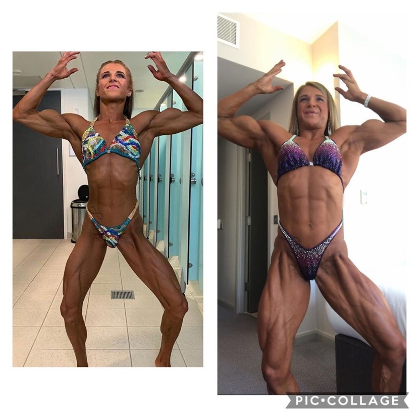 From anorexia to bodybuilding
