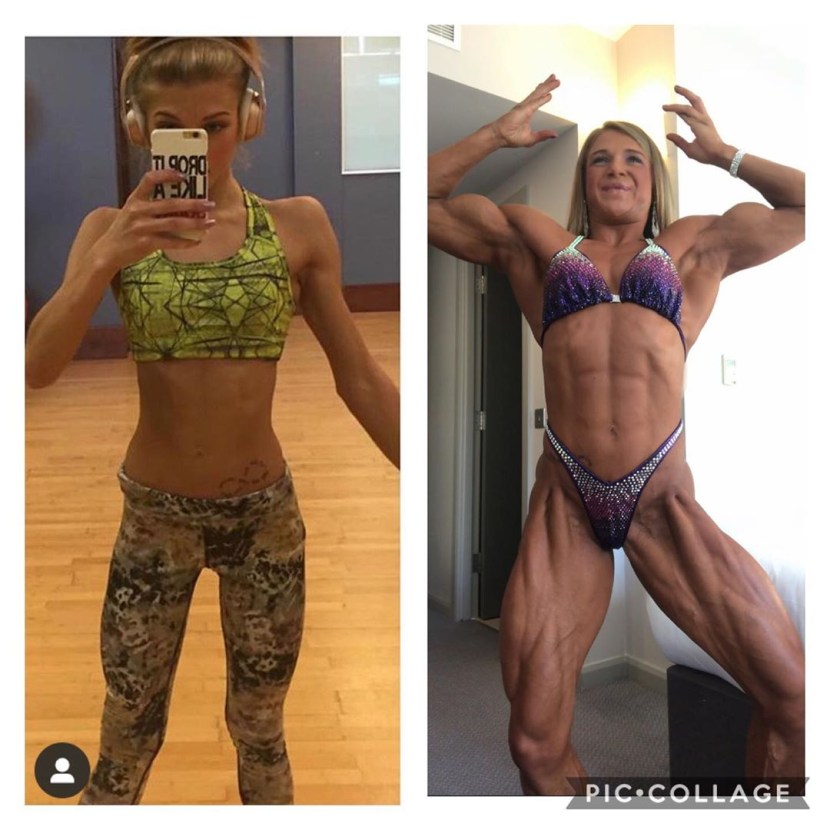 Anorexia Bodybuilding