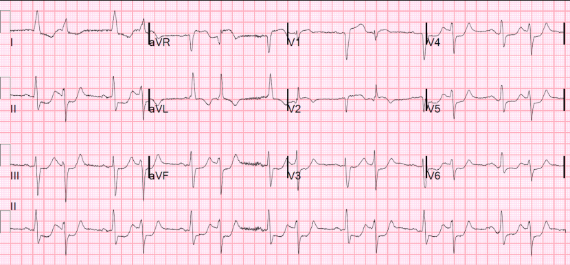 Hot Bird Eurotic TV Show Scarlett Naked Pussy