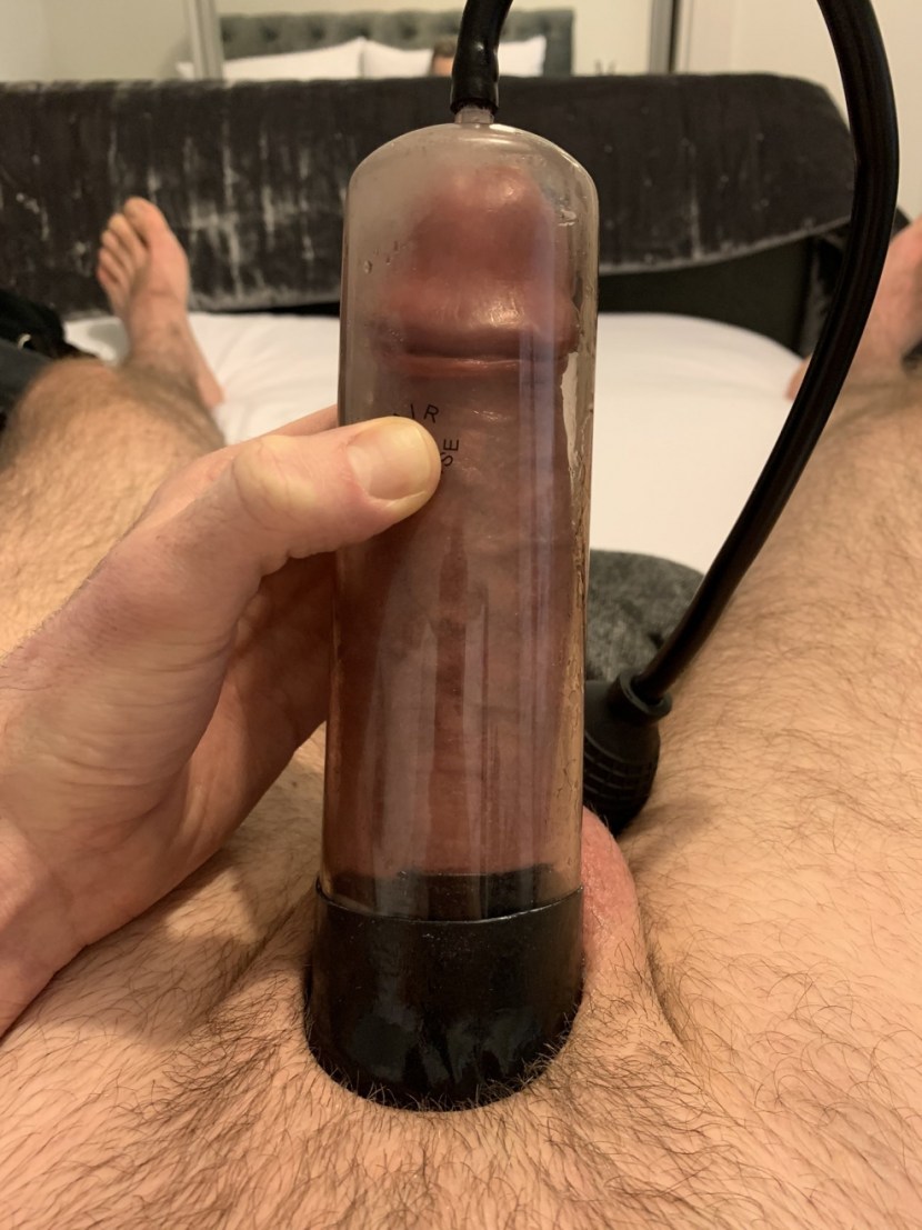 Anal vacuum pump