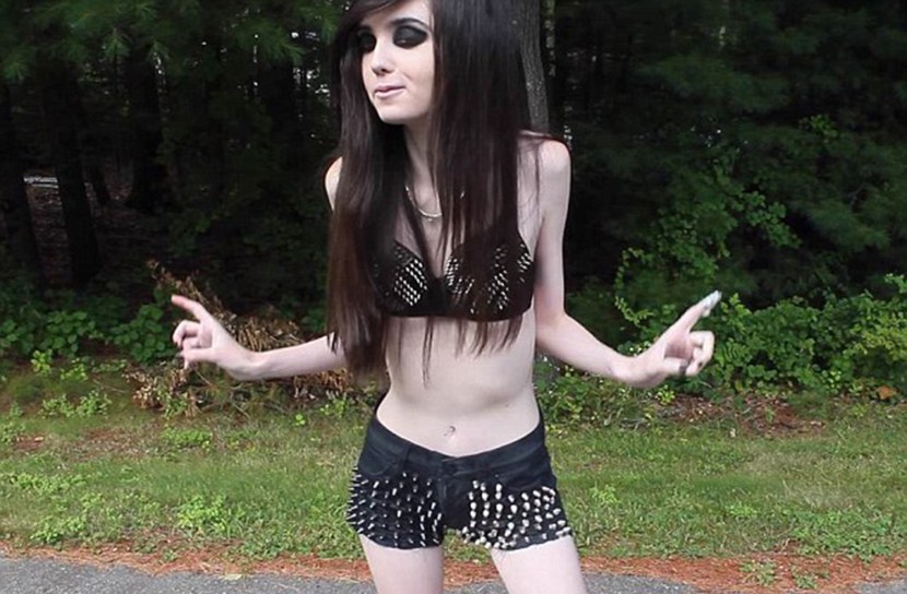 Anorexic Gothic girls