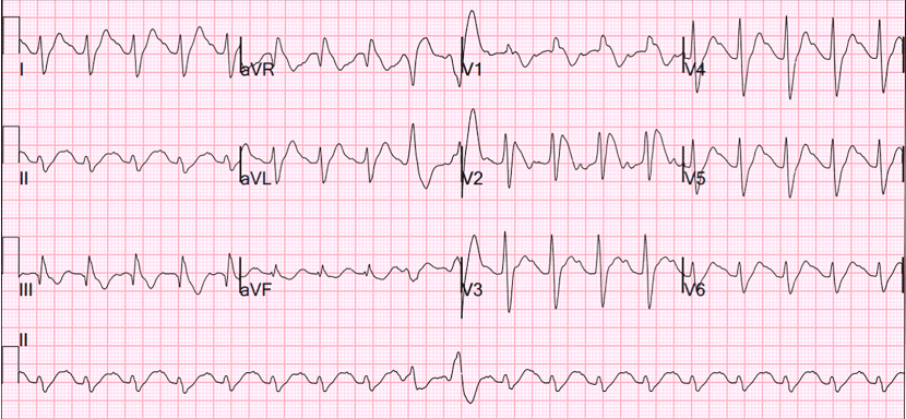 Man with binoculars meme