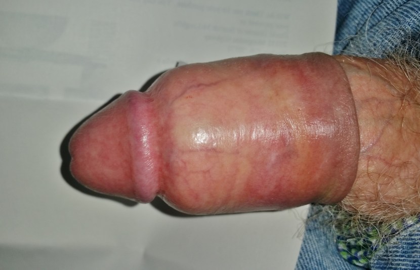 Cock and Ball Torture Devices