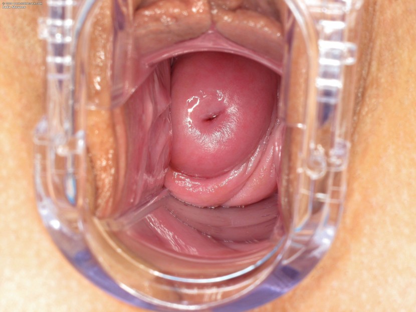Vagina and uterus from the inside