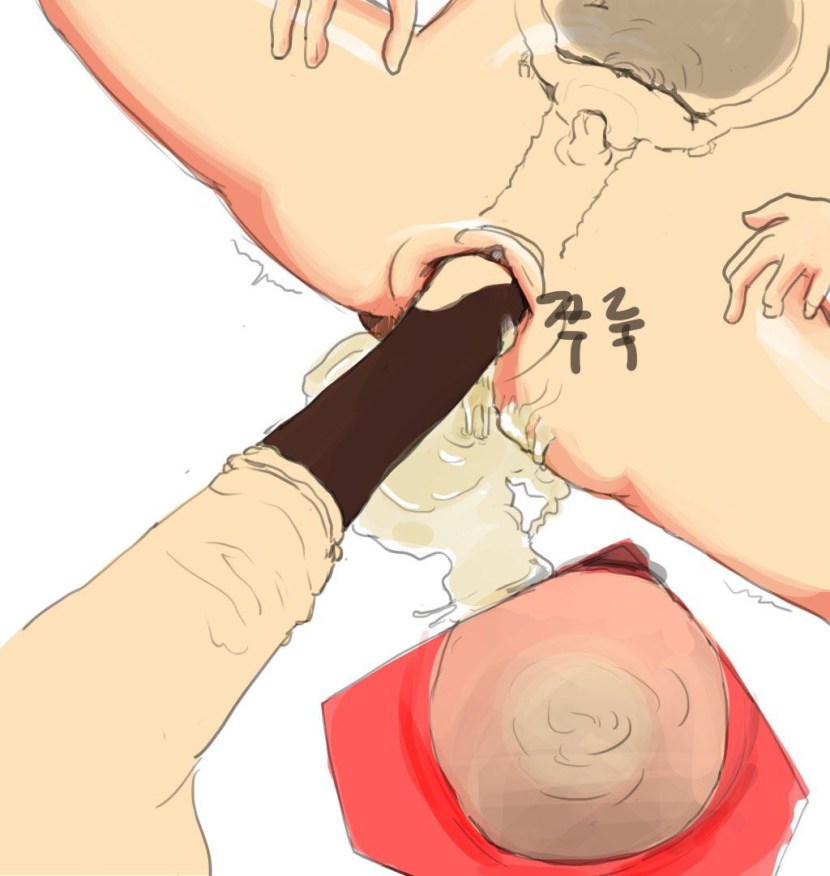 Opened the vagina showed the uterus