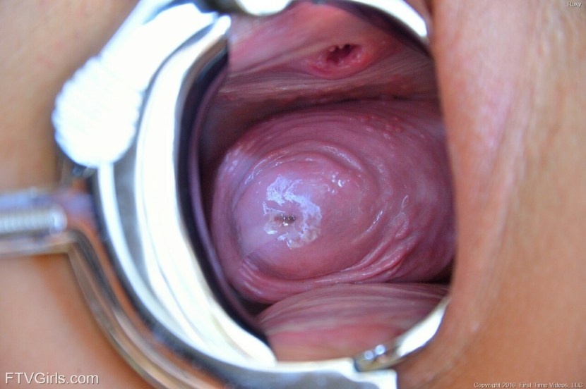 A small process in the vagina