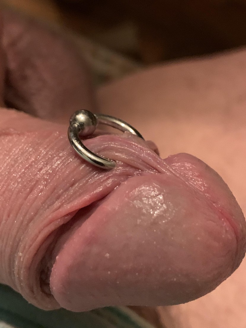 The foreskin in the belt of fidelity