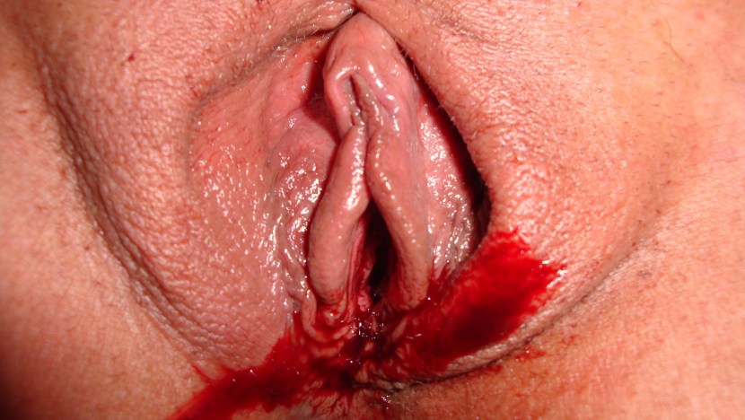 Women's pussy in blood