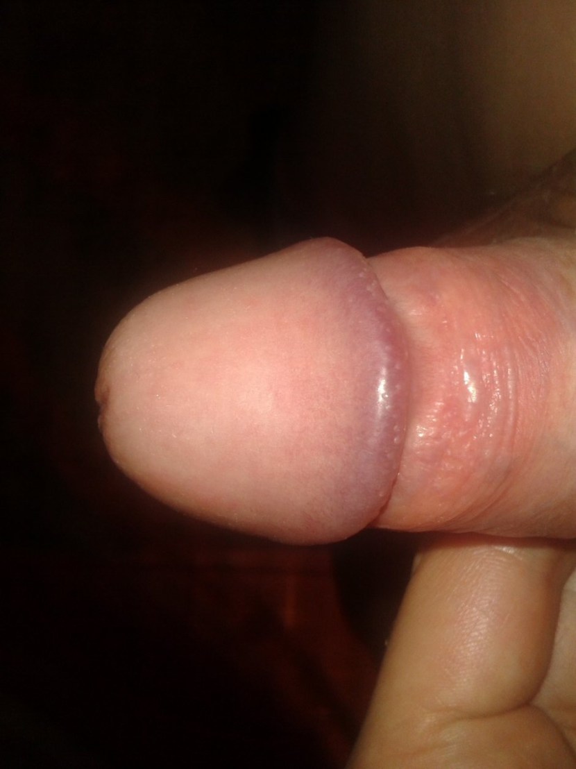 The head of the penis