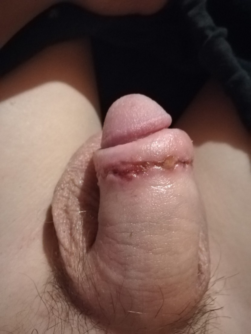 Sucking a member with the foreskin