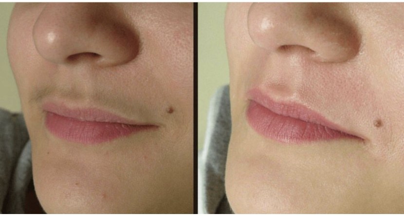 Love of teenagers 14 years old