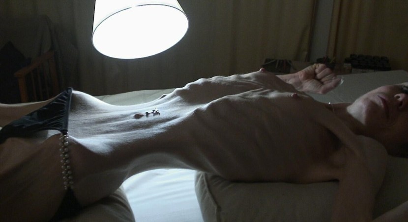 Naked women anorexics