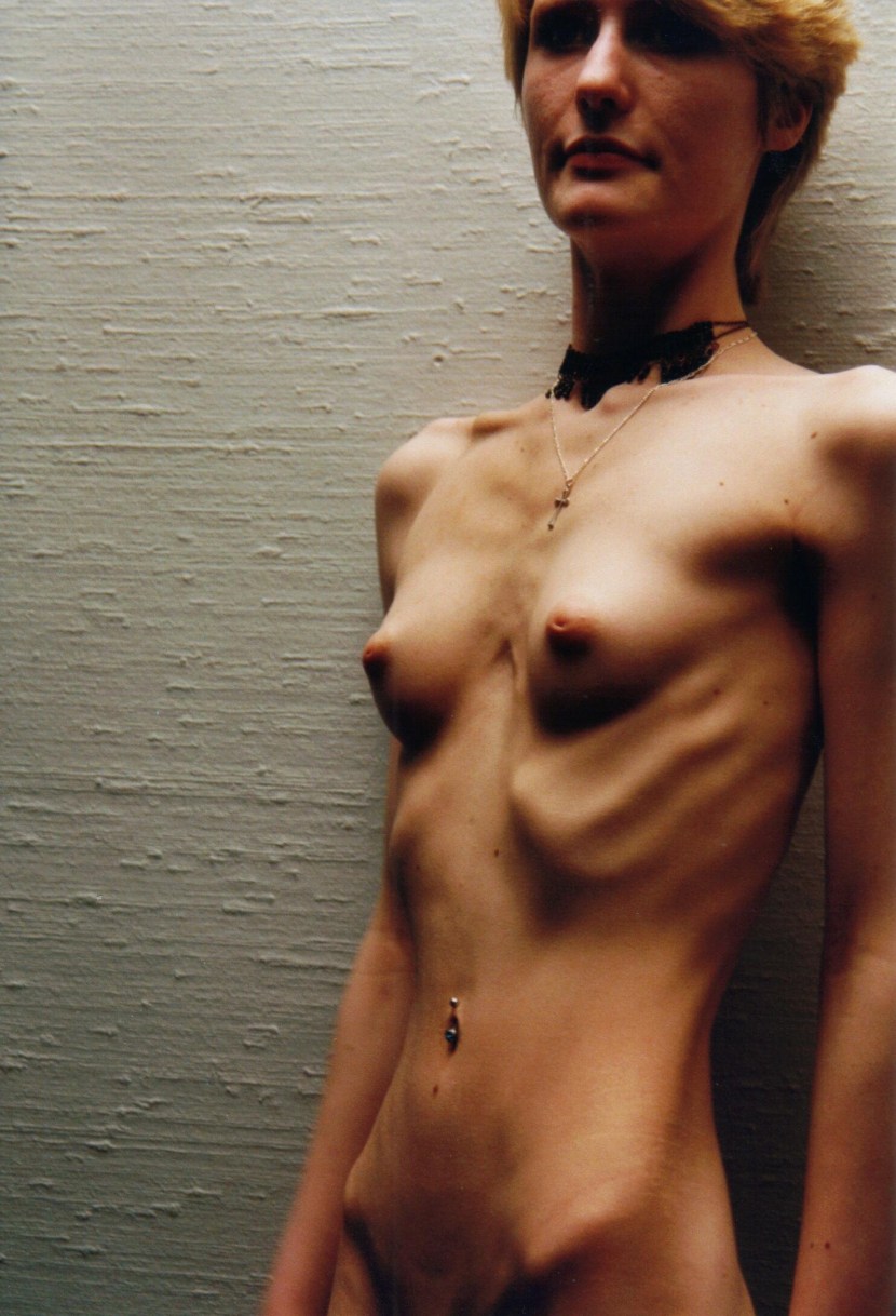 Naked thin anorexica