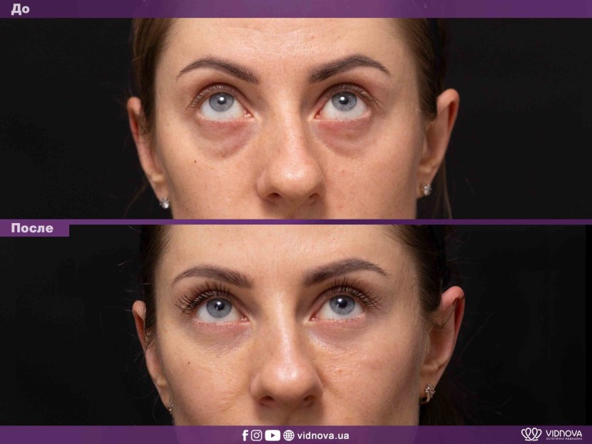 How the jester is miserable on the throne of the king how stupid people who allowed