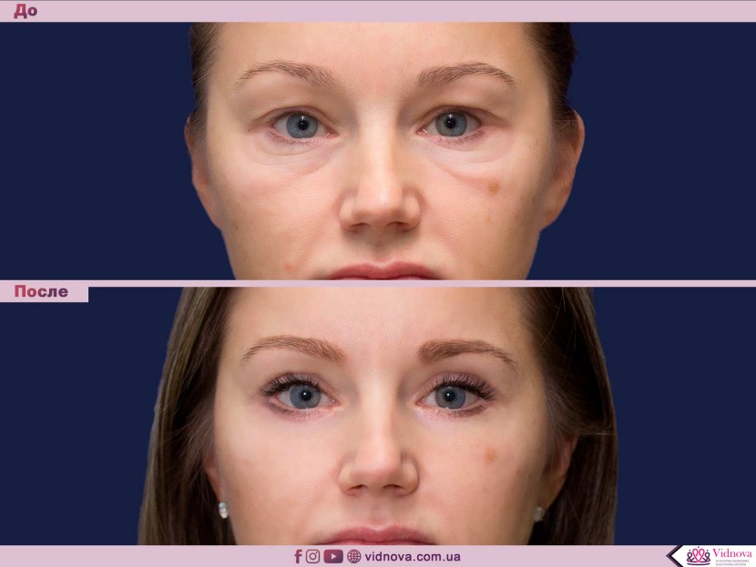 Alesya Molebu photo naked