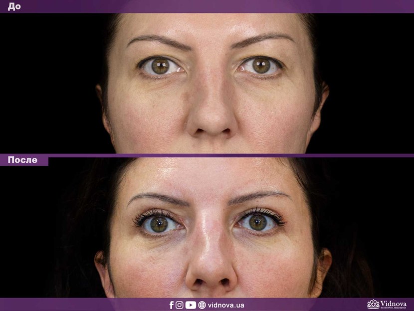 Karl Jesse Porn actress