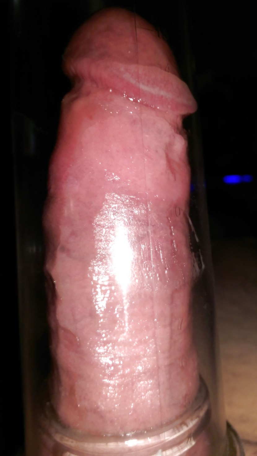 Erectational rings for dick