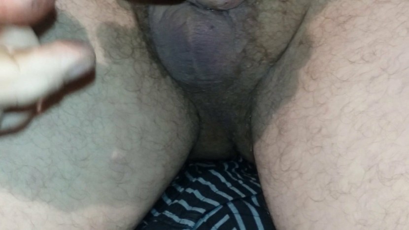 Laser vulvo-vaginal rejuvenation