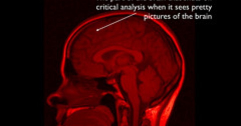 Your Brain on Drugs Be Like