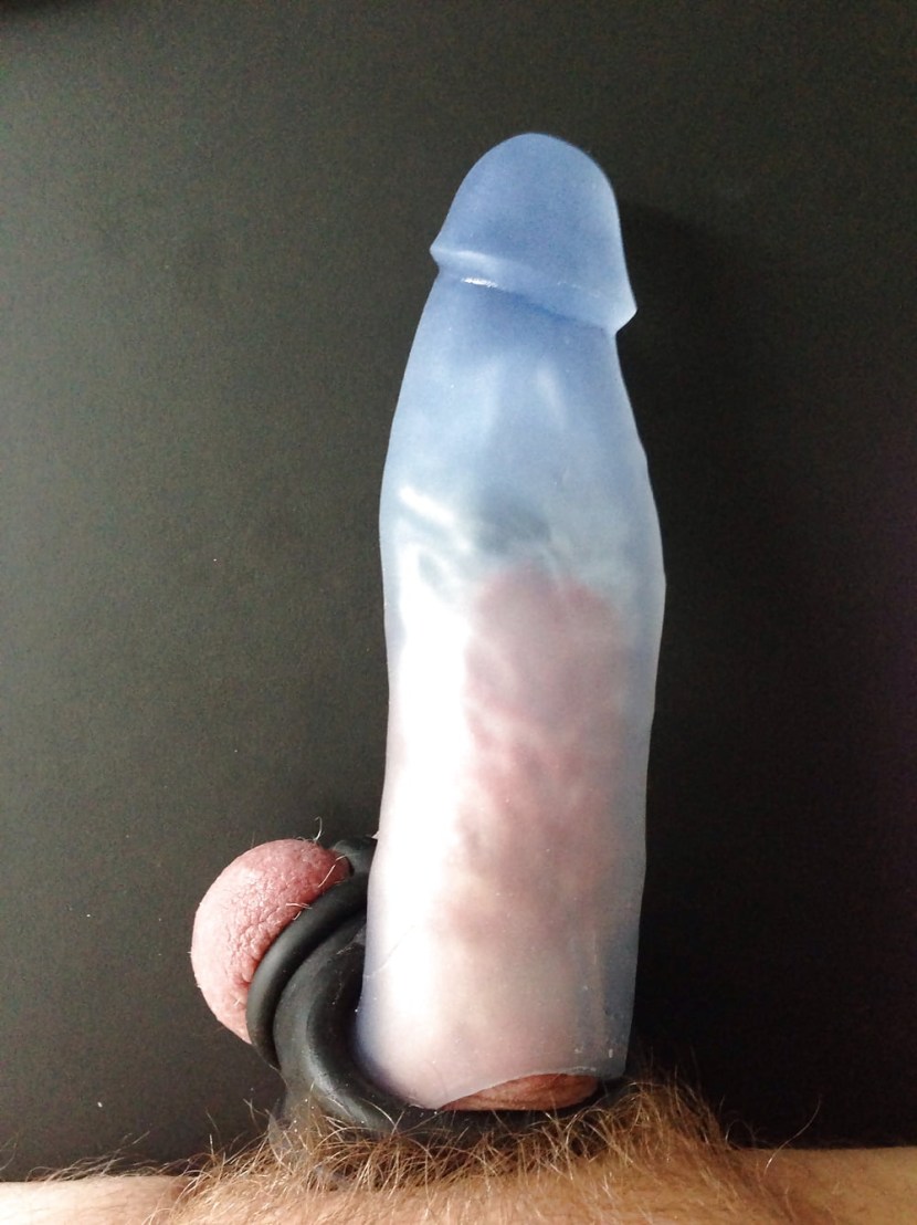 Unusual penis of men